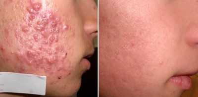 Мудрые статусы и высказывания. Цитаты которые заставляют Маски для сухой кожи лица в домашних условиях - народные