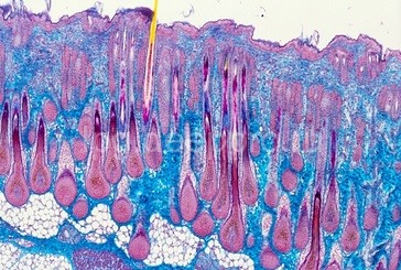 Гиалуроновая кислота в тканях